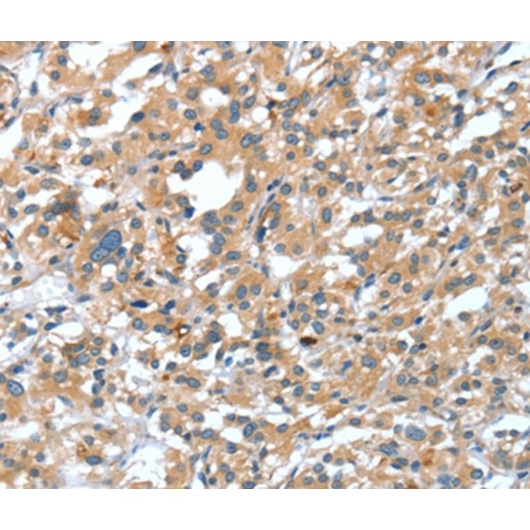 Immunohistochemistry - DSC1 Antibody from Signalway Antibody (37529) - Antibodies.com