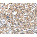 Immunohistochemistry - DSC1 Antibody from Signalway Antibody (37529) - Antibodies.com