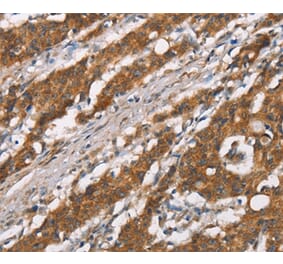 Immunohistochemistry - DSC2 Antibody from Signalway Antibody (37530) - Antibodies.com