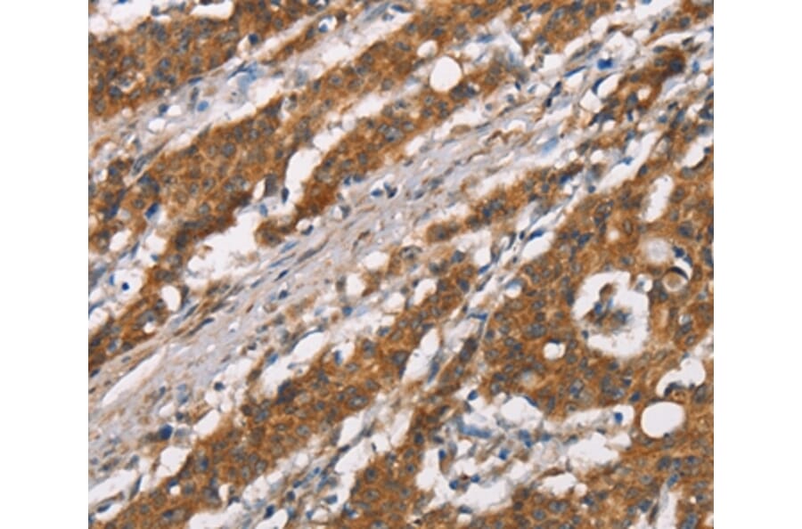 Immunohistochemistry - DSC2 Antibody from Signalway Antibody (37530) - Antibodies.com