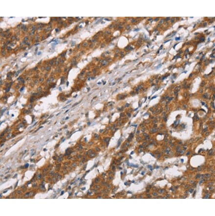 Immunohistochemistry - DSC2 Antibody from Signalway Antibody (37530) - Antibodies.com