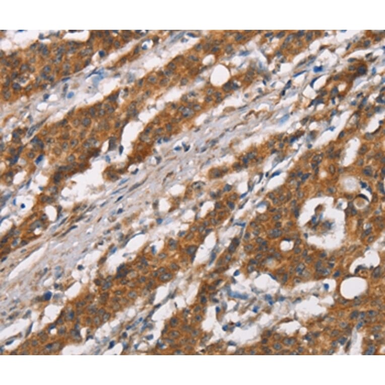 Immunohistochemistry - DSC2 Antibody from Signalway Antibody (37530) - Antibodies.com