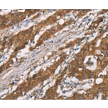 Immunohistochemistry - DSC2 Antibody from Signalway Antibody (37530) - Antibodies.com