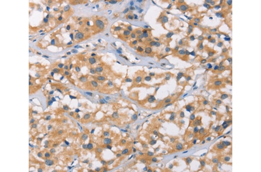 Immunohistochemistry - DSC2 Antibody from Signalway Antibody (37530) - Antibodies.com