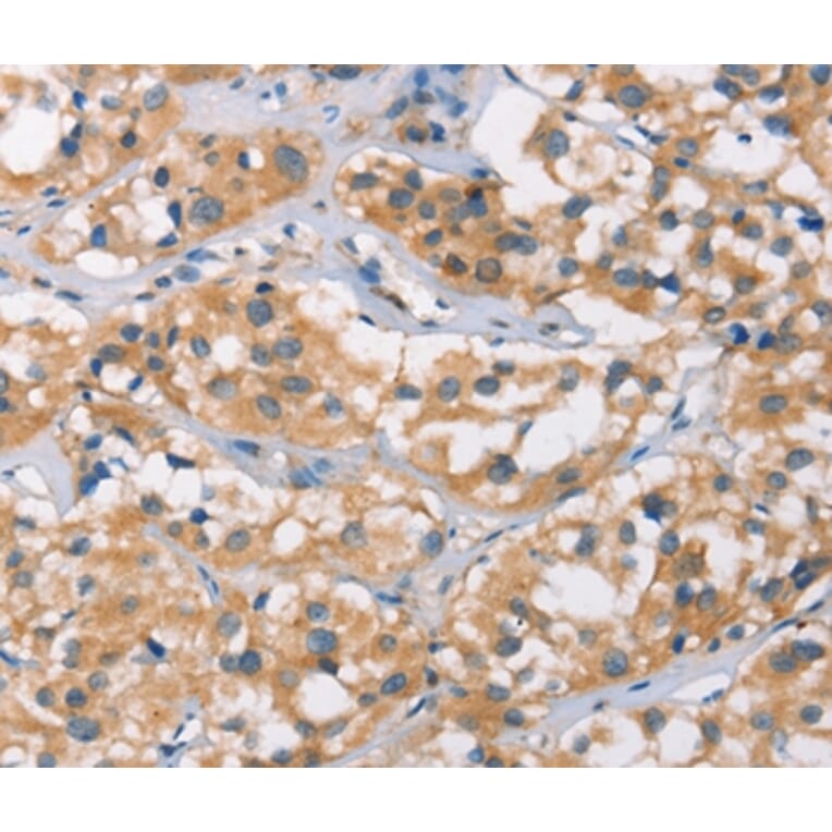 Immunohistochemistry - DSC2 Antibody from Signalway Antibody (37530) - Antibodies.com