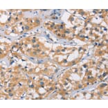 Immunohistochemistry - DSC2 Antibody from Signalway Antibody (37530) - Antibodies.com