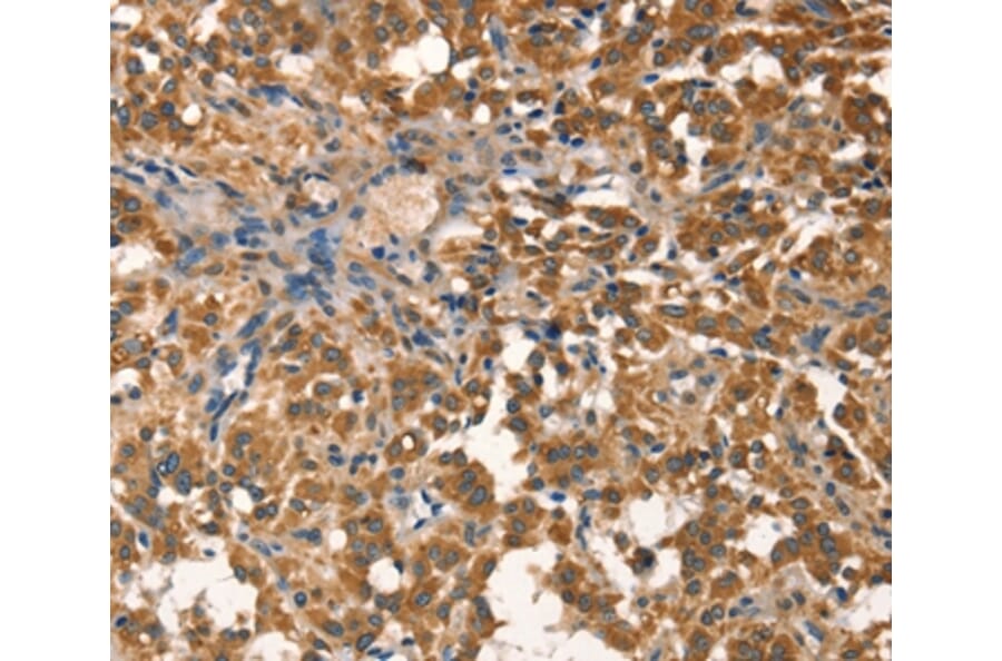Immunohistochemistry - AGO1 Antibody from Signalway Antibody (37543) - Antibodies.com