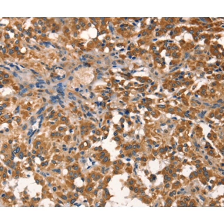 Immunohistochemistry - AGO1 Antibody from Signalway Antibody (37543) - Antibodies.com