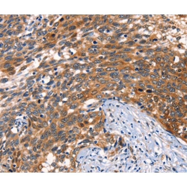 Immunohistochemistry - AGO1 Antibody from Signalway Antibody (37543) - Antibodies.com