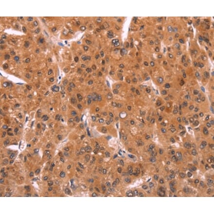 Immunohistochemistry - EMP2 Antibody from Signalway Antibody (37546) - Antibodies.com