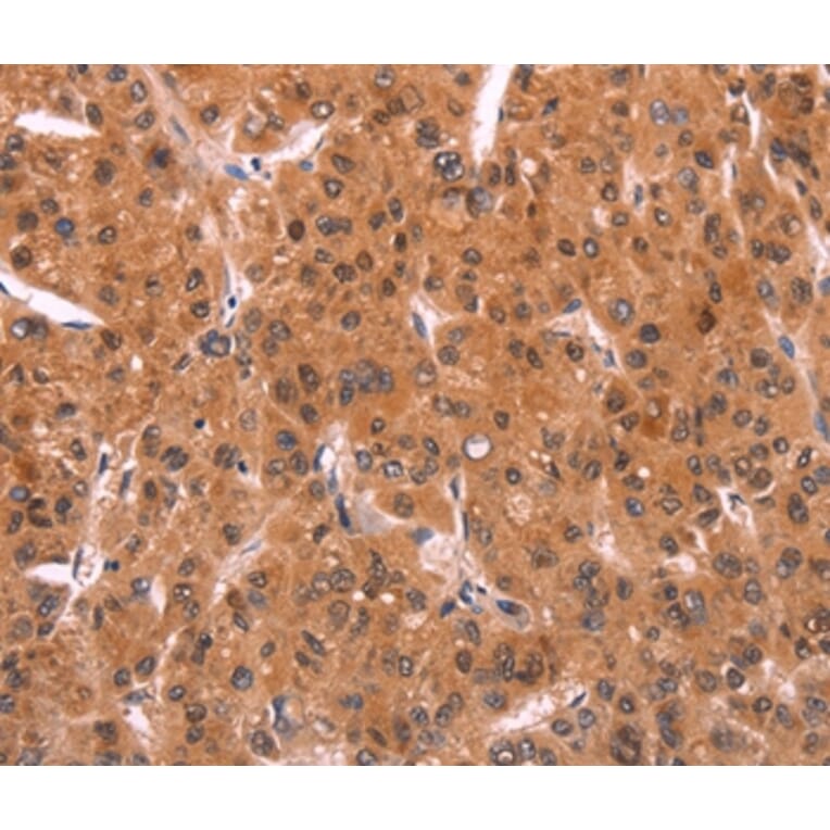 Immunohistochemistry - EMP2 Antibody from Signalway Antibody (37546) - Antibodies.com