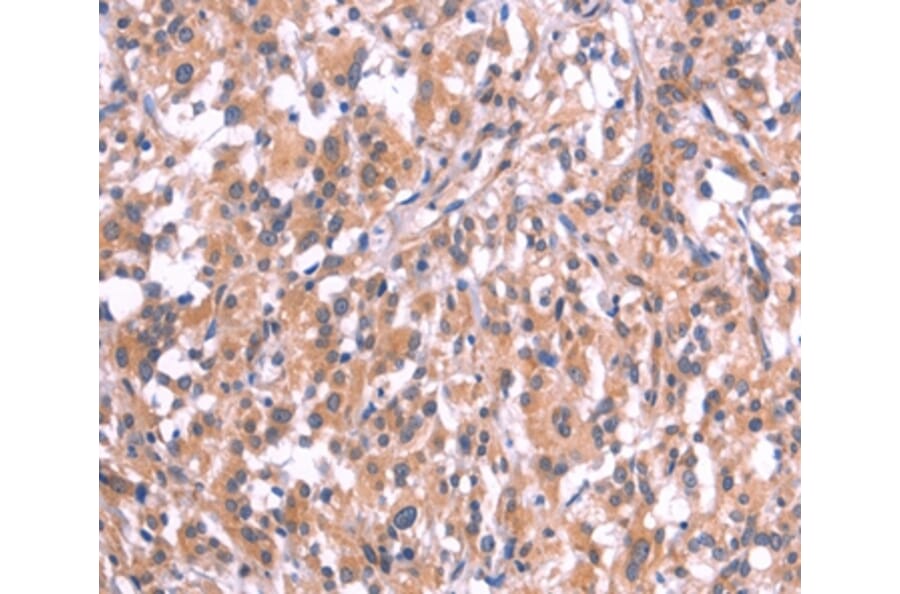 Immunohistochemistry - EMP2 Antibody from Signalway Antibody (37546) - Antibodies.com