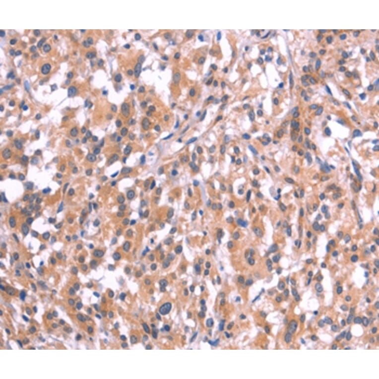 Immunohistochemistry - EMP2 Antibody from Signalway Antibody (37546) - Antibodies.com