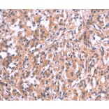 Immunohistochemistry - EMP2 Antibody from Signalway Antibody (37546) - Antibodies.com