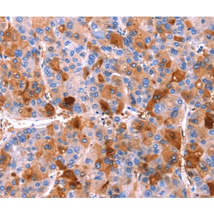 Immunohistochemistry - ERN2 Antibody from Signalway Antibody (37554) - Antibodies.com