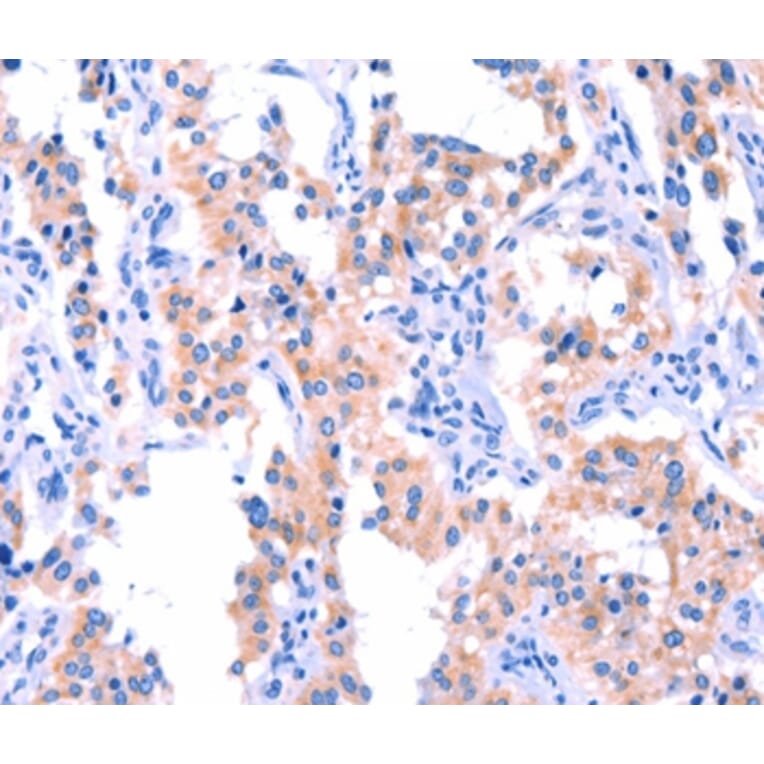 Immunohistochemistry - ERN2 Antibody from Signalway Antibody (37554) - Antibodies.com