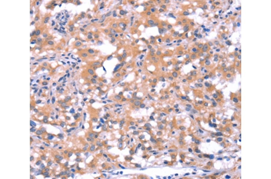 Immunohistochemistry - FAT1 Antibody from Signalway Antibody (37566) - Antibodies.com