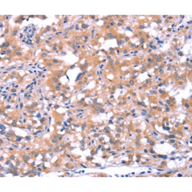 Immunohistochemistry - FAT1 Antibody from Signalway Antibody (37566) - Antibodies.com