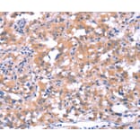 Immunohistochemistry - FAT1 Antibody from Signalway Antibody (37566) - Antibodies.com