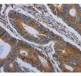 Immunohistochemistry - FPR3 Antibody from Signalway Antibody (37576) - Antibodies.com