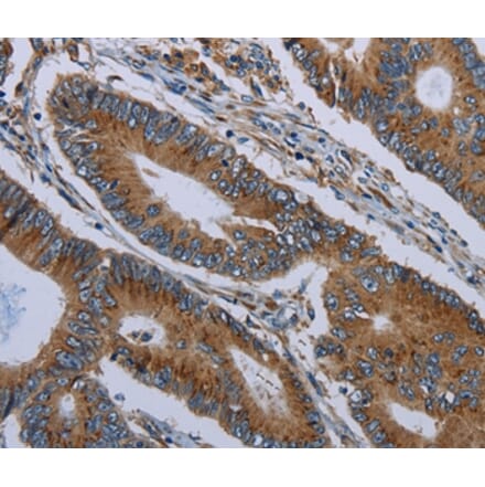 Immunohistochemistry - FPR3 Antibody from Signalway Antibody (37576) - Antibodies.com