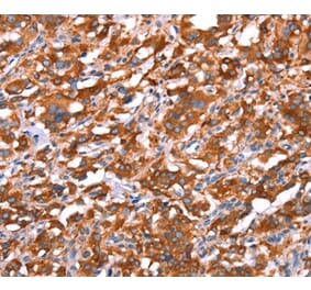 Immunohistochemistry - GAS8 Antibody from Signalway Antibody (37587) - Antibodies.com
