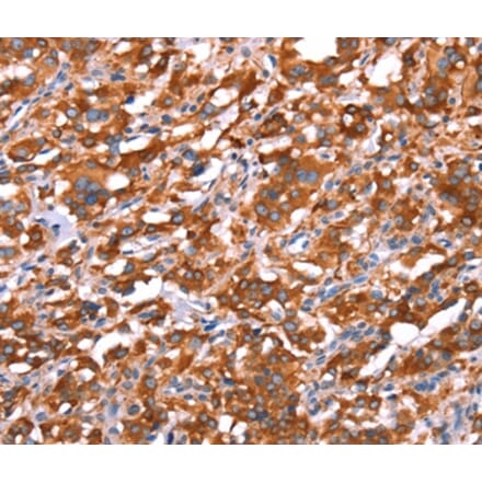 Immunohistochemistry - GAS8 Antibody from Signalway Antibody (37587) - Antibodies.com