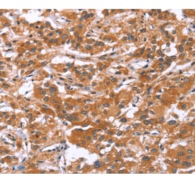 Immunohistochemistry - GLMN Antibody from Signalway Antibody (37595) - Antibodies.com