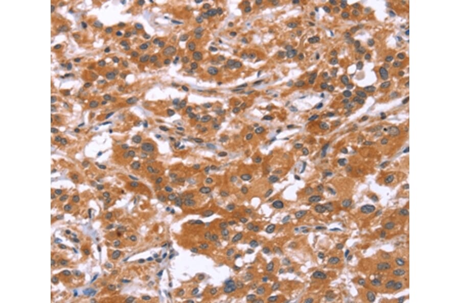 Immunohistochemistry - GLMN Antibody from Signalway Antibody (37595) - Antibodies.com