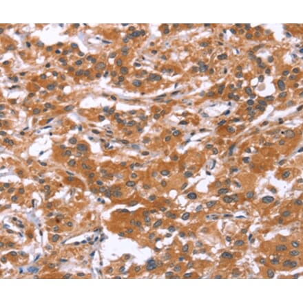 Immunohistochemistry - GLMN Antibody from Signalway Antibody (37595) - Antibodies.com