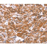 Immunohistochemistry - GLMN Antibody from Signalway Antibody (37595) - Antibodies.com