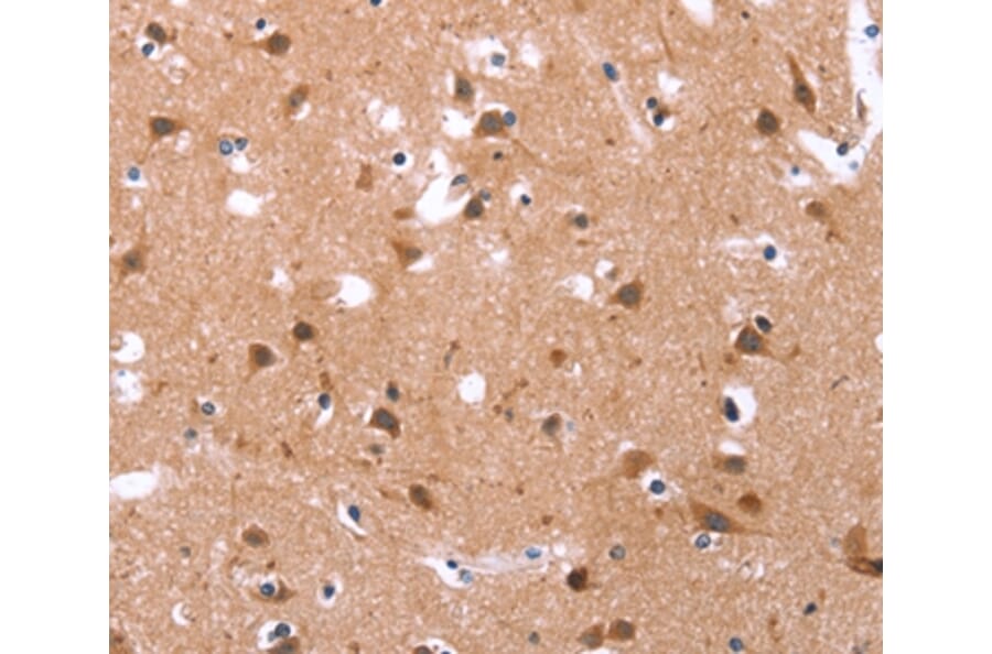 Immunohistochemistry - GLMN Antibody from Signalway Antibody (37595) - Antibodies.com