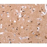 Immunohistochemistry - GLMN Antibody from Signalway Antibody (37595) - Antibodies.com