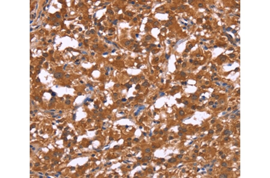Immunohistochemistry - HLTF Antibody from Signalway Antibody (37621) - Antibodies.com