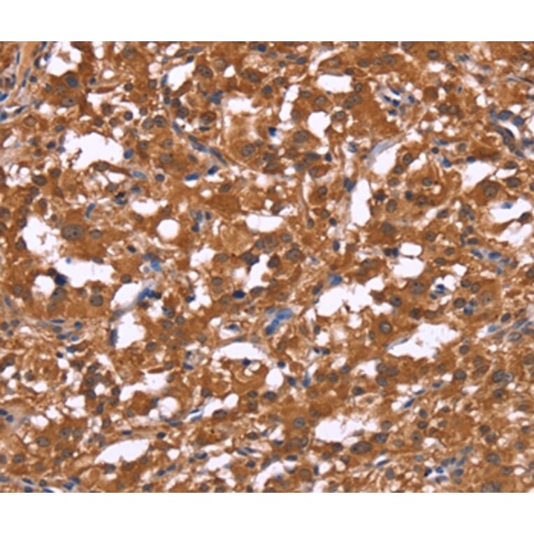 Immunohistochemistry - HLTF Antibody from Signalway Antibody (37621) - Antibodies.com