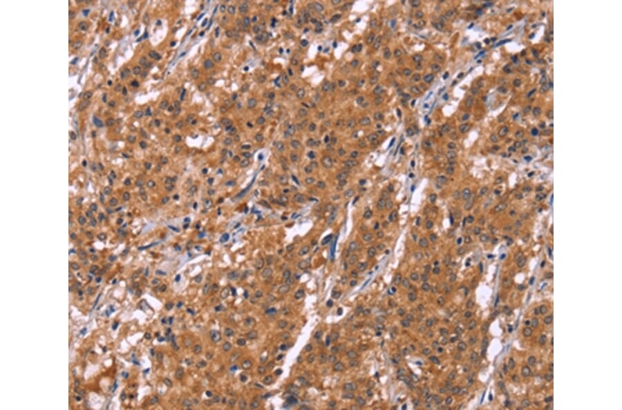 Immunohistochemistry - HLTF Antibody from Signalway Antibody (37621) - Antibodies.com