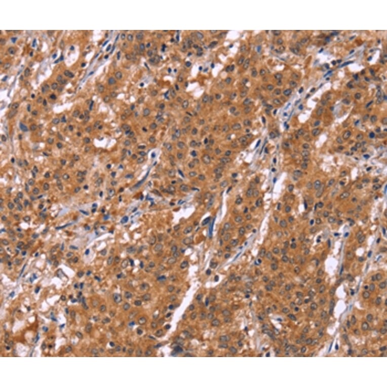 Immunohistochemistry - HLTF Antibody from Signalway Antibody (37621) - Antibodies.com