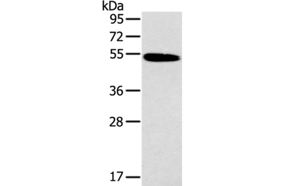 HRH1 Antibody from Signalway Antibody (37630) - Antibodies.com
