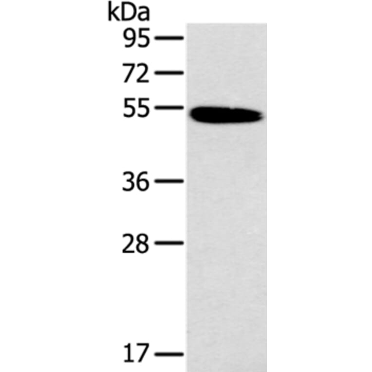 HRH1 Antibody from Signalway Antibody (37630) - Antibodies.com