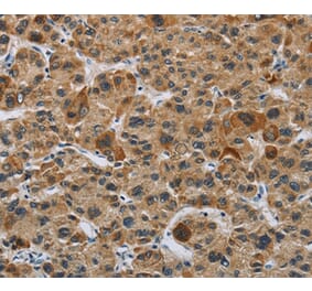 Immunohistochemistry - IL31 Antibody from Signalway Antibody (37651) - Antibodies.com