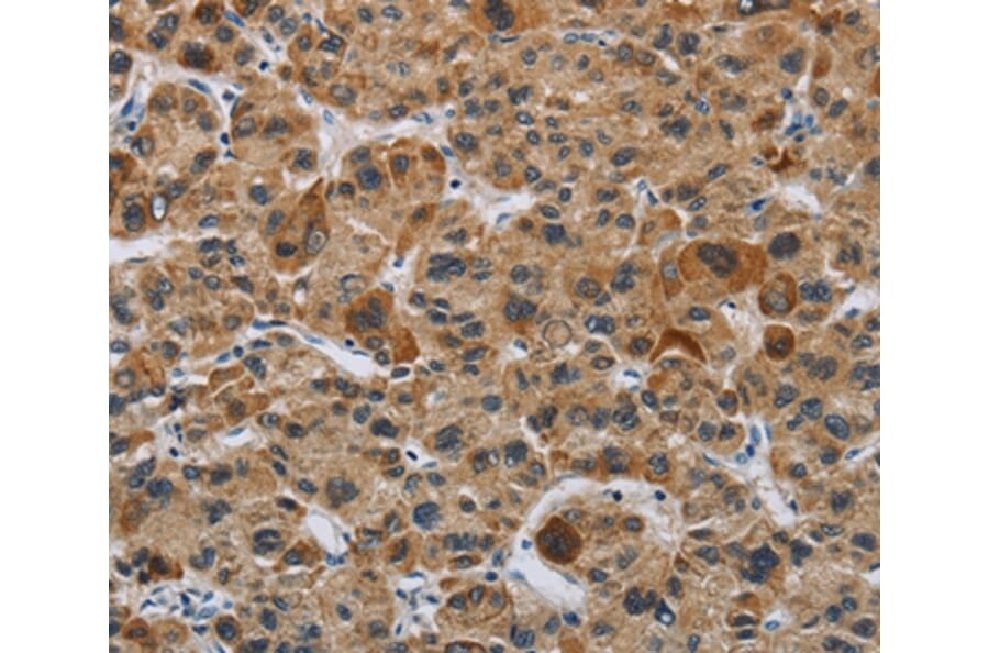 Immunohistochemistry - IL31 Antibody from Signalway Antibody (37651) - Antibodies.com