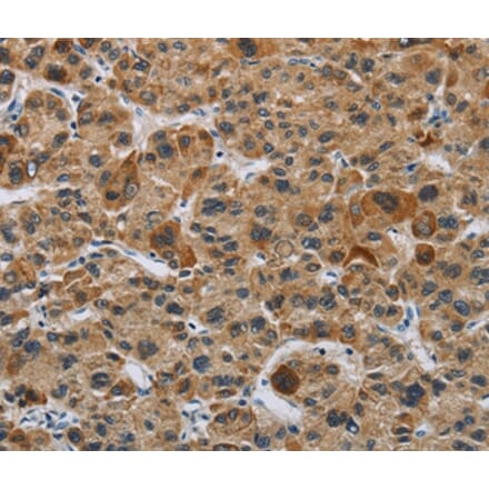 Immunohistochemistry - IL31 Antibody from Signalway Antibody (37651) - Antibodies.com