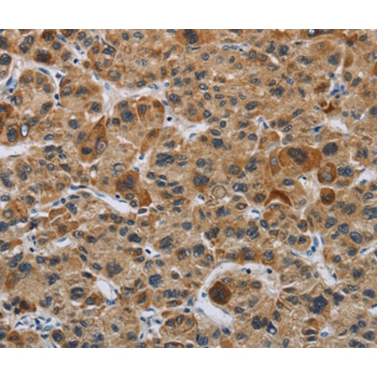 Immunohistochemistry - IL31 Antibody from Signalway Antibody (37651) - Antibodies.com