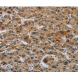 Immunohistochemistry - IL31 Antibody from Signalway Antibody (37651) - Antibodies.com