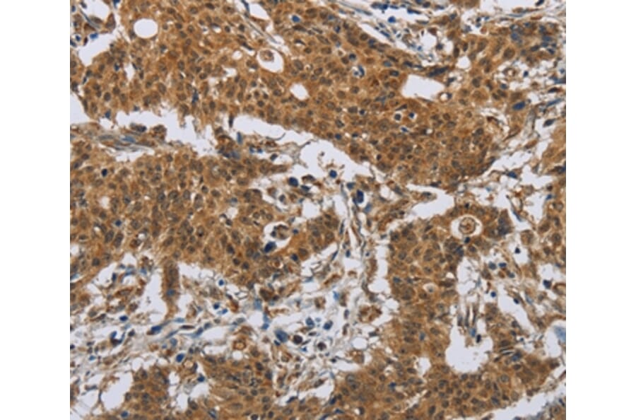 Immunohistochemistry - IL31 Antibody from Signalway Antibody (37651) - Antibodies.com