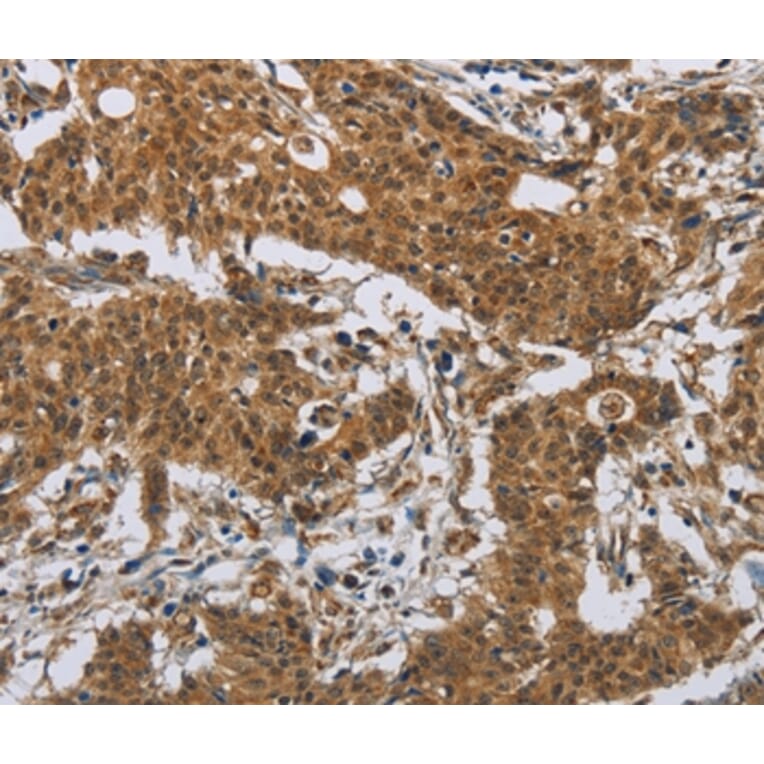 Immunohistochemistry - IL31 Antibody from Signalway Antibody (37651) - Antibodies.com