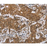 Immunohistochemistry - IL31 Antibody from Signalway Antibody (37651) - Antibodies.com