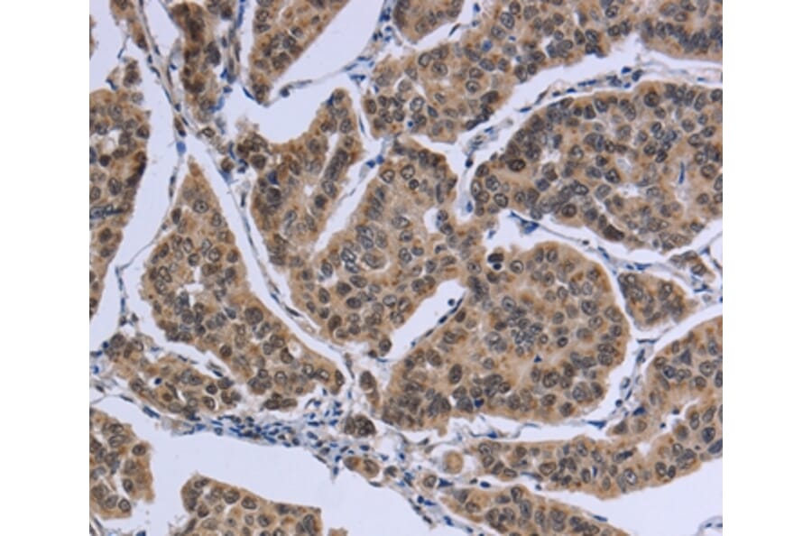 Immunohistochemistry - IPO8 Antibody from Signalway Antibody (37659) - Antibodies.com
