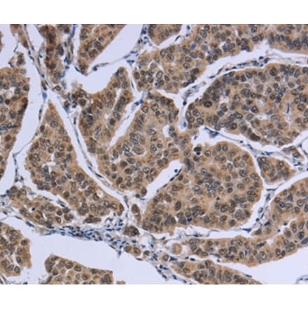 Immunohistochemistry - IPO8 Antibody from Signalway Antibody (37659) - Antibodies.com