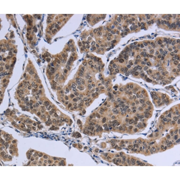 Immunohistochemistry - IPO8 Antibody from Signalway Antibody (37659) - Antibodies.com